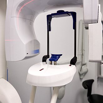 A 3D cone beam scanner