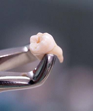 Close up of forceps holding tooth