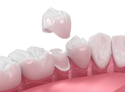 Shiny, 3D rendering of a dental crown in lower jaw with white background