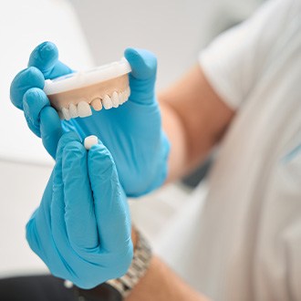 Dentist holding sample crown over model tooth